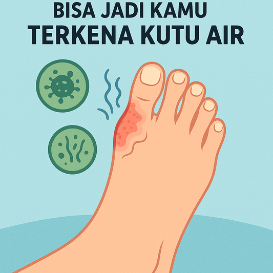 🦠 “Kaki Gatal dan Mengelupas? Bisa Jadi Kamu Terkena KUTU AIR, Bukan Sekadar Jamur Biasa!”